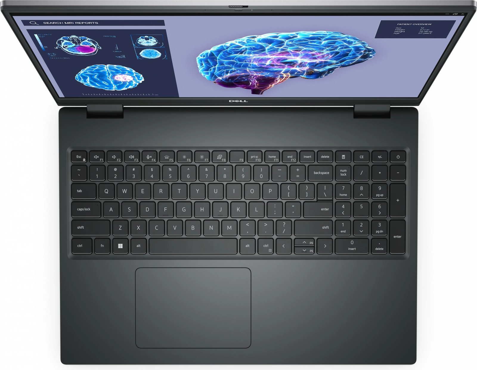 Laptop DELL Precision 7680, Intel Core i7, 32 GB RAM, 1 TB SSD, 16 inch, Gri